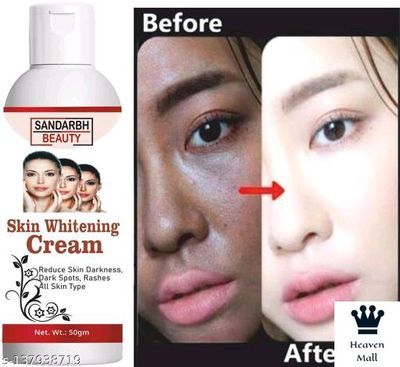 Sandarbh Skin Whitening Lotion Cream Look as young as U feel Acne